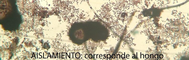 corresponde al hongo Aspergillus spp, identificado en 28 cepas obtenidas de la superficie hisopada de los Legajo/Libro Cuenta incluidos en el estudio.