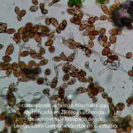 AISLAMIENTO, corresponde al hongo Alternaria spp, identificado en 28 cepas obtenidas de la superficie hisopada de los Legajo/Libro Cuenta incluidos en el estudio.